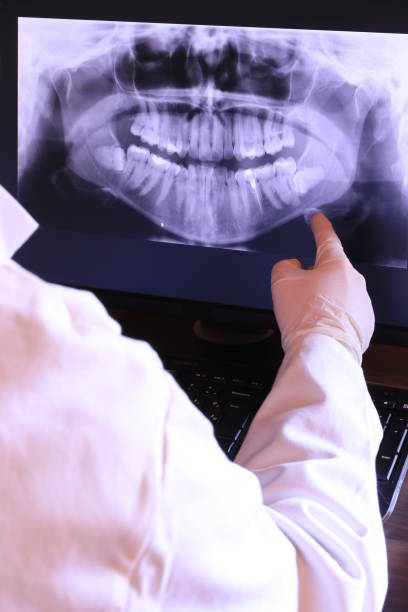 Best Emergency Root Canal Therapy in Glenside, PA